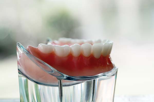 Getting Dentures To Replace Missing Teeth