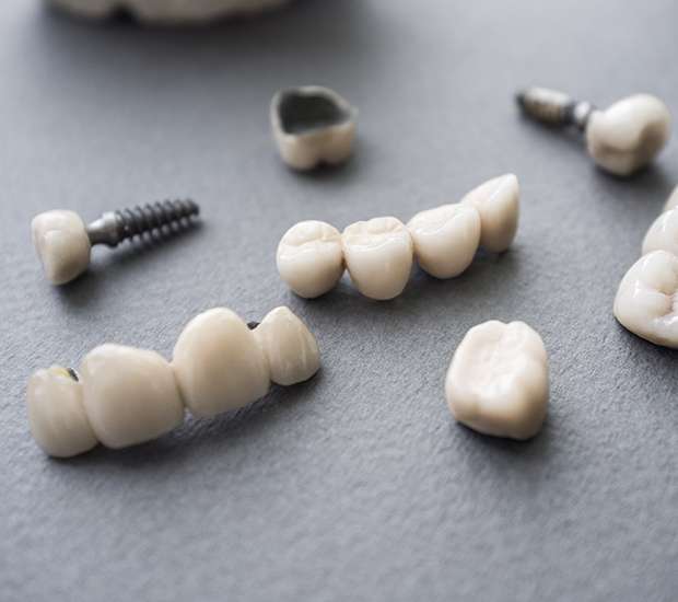 Safford The Difference Between Dental Implants and Mini Dental Implants